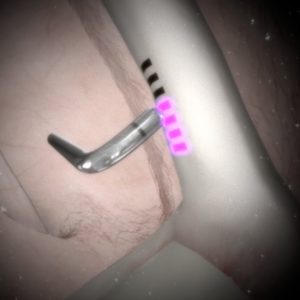 Complete Shoulder Arthroscopy