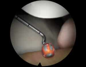Hip Diagnostics