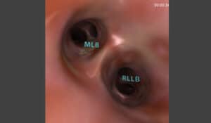 CHEST Standardized curriculum