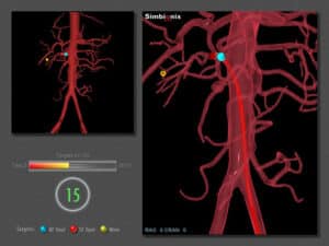 Endovascular basic skills