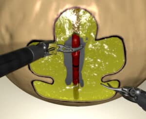 Vessel Energy Dissection