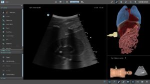 Advanced Abdominal