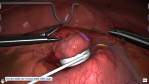 Bariatrics