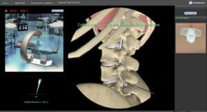Lumbar puncture
