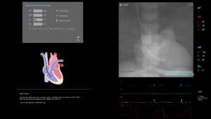 Bedside Catheterize
