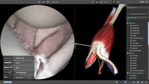 Shoulder Labral Repair